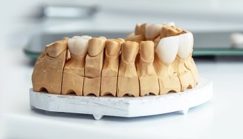 The Longevity of Dental Veneers: Tips for Prolonging Their Lifespan