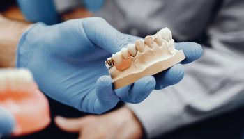Why Dental Bridges Are a Trusted Solution for Restoring Smiles