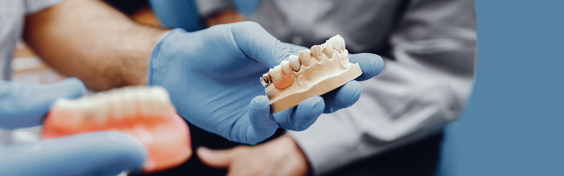 Why Dental Bridges Are a Trusted Solution for Restoring Smiles