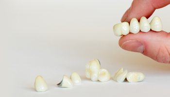 The Dental Crown Procedure: Step-by-Step from Start to Finish