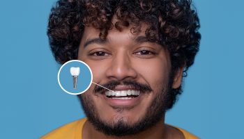 How Do Dental Implants Work? From Placement to Final Smile