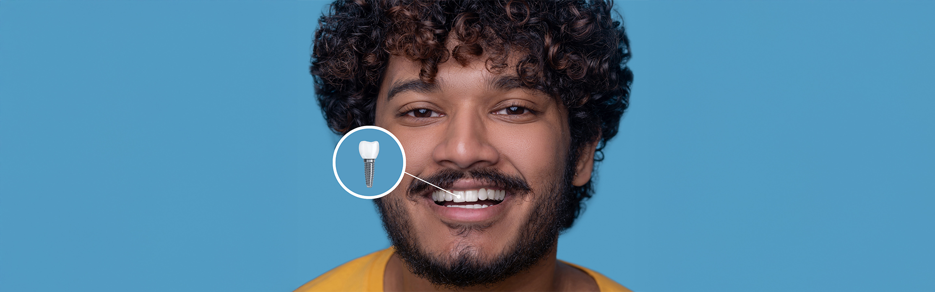 How Do Dental Implants Work? From Placement to Final Smile