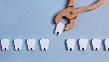The Role of Tooth Extraction in All-round Oral Health
