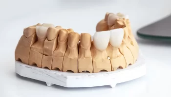 How Proper Care Impacts the Lifespan of Dental Veneers