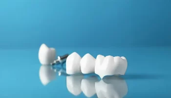 What Happens If You Delay Getting a Dental Crown?